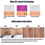 Buy 3 Lampes Hair Removal System IPL Permanent Face Body Hair Removal Device Online in UAE