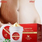 Buy EDTara Scar Removal Cream Online in UAE