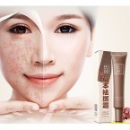 skin whitening cream dark spot corrector skin lightening & whitening age spot shop online in UAE