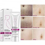 RtopR Mango Stretch Marks and Scar Cream -Stretch Marks and Scar Removal Cream for Pregnancy - Best Body Moisturizer-40g