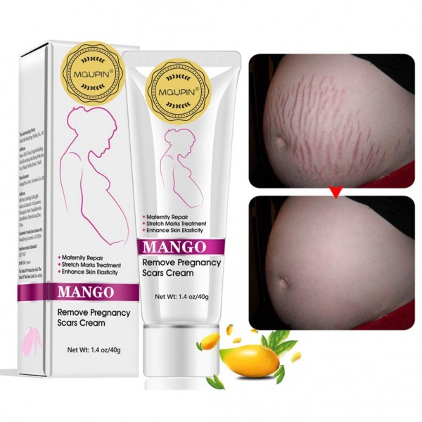 Rtopr Mango Stretch Marks And Scar Cream -stretc..