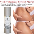 Voibella Beauty Scar Removal Cream | Best Cream for Old or New Acne & Stretch Marks Buy in UAE