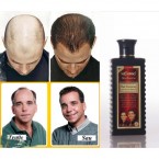 Hair Nurturing Anti Hair Loss Shampoo Available at Online Sale in UAE